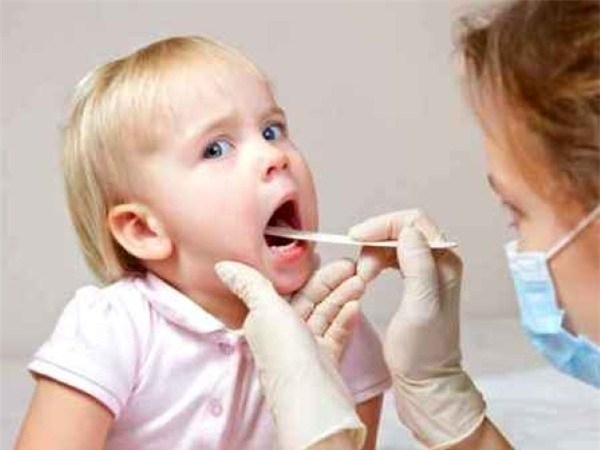 Cách điều trị bệnh viêm mũi họng ở trẻ em