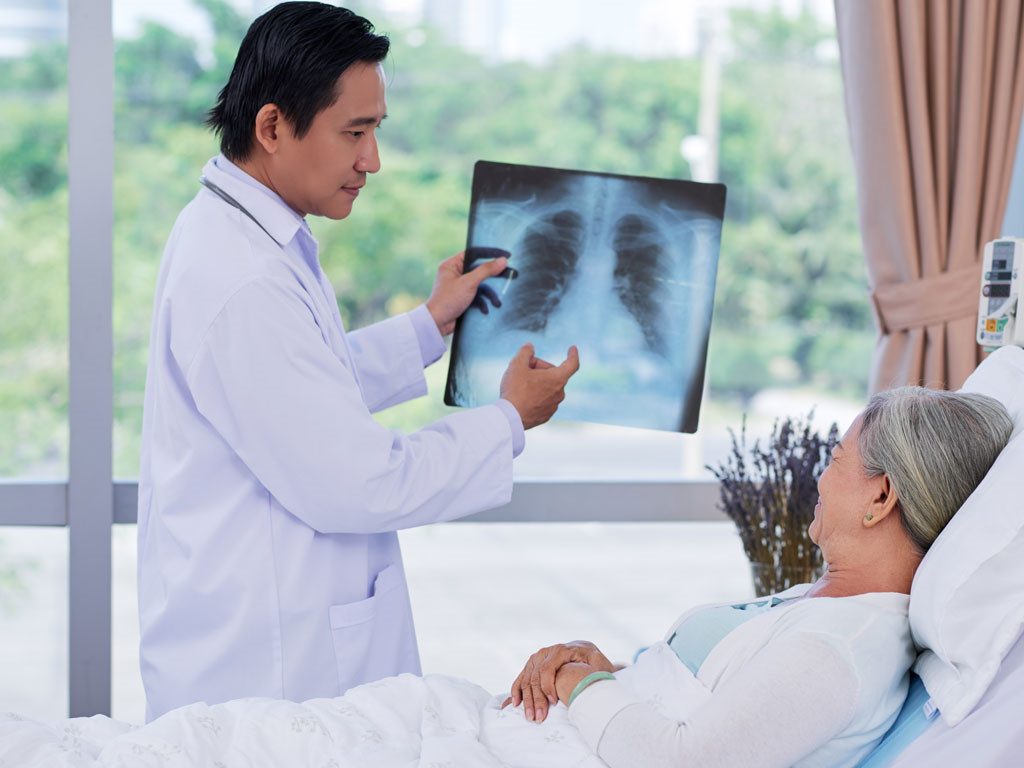 Dấu hiệu và cách điều trị bệnh viêm phổi ở người cao tuổi