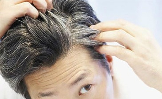 8 bài thuốc chữa tóc bạc sớm bằng đông y hiệu quả bất ngờ và nhanh nhất.