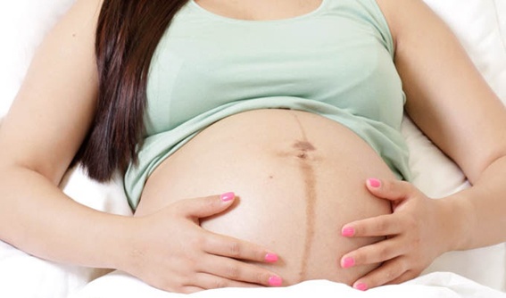 Dấu hiệu chuyển dạ sắp sinh con sớm của bà bầu một cách chính xác nhất