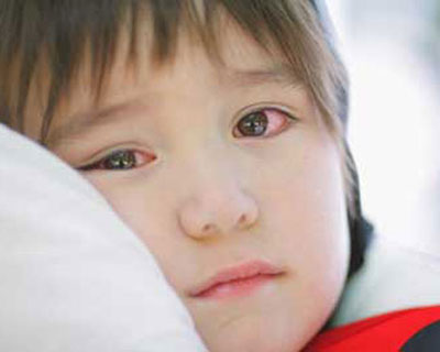 Bệnh đau mắt đỏ lây lan qua những con đường nào? Cách khắc phục tốt nhất tình trạng bệnh đau mắt đỏ này. 