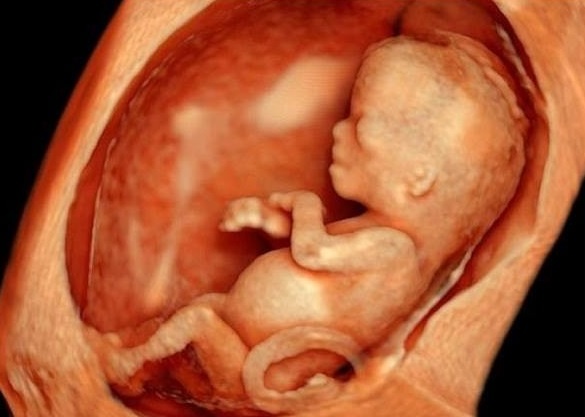 Dấu hiệu nhận biết thai chết lưu sớm nhất trong 3 tháng đầu và cách giải quyết.