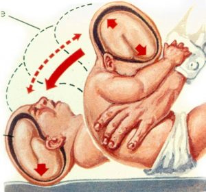  tác hại của việc rung lắc trẻ sơ sinh
