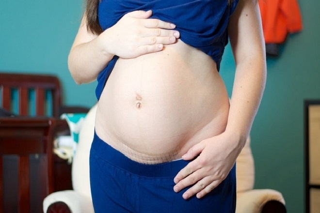 Mẹ bầu đau vết mổ đẻ khi mang thai lần 2 thường gặp phải những nguy cơ gì?